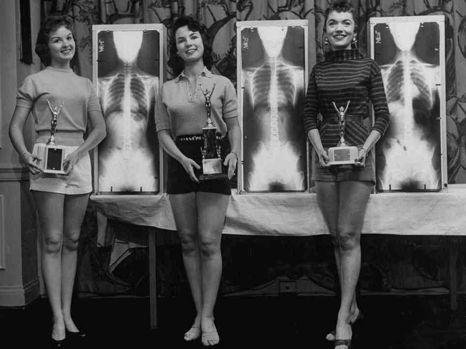 Contestants (from left) Marianne Baba (third place), Lois Conway and Ruth Swenson pose with trophies and their X-rays. Photo Credit: Wallace Kirkland/LIFE